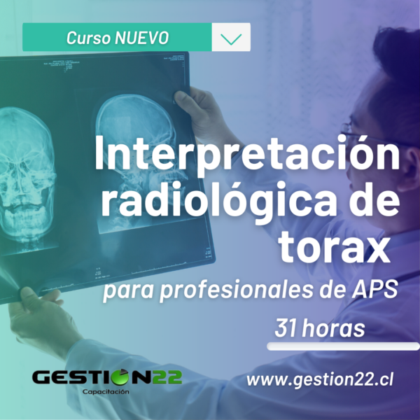 Interpretaci N Radiol Gica De Torax Para Profesionales De Aps Otec